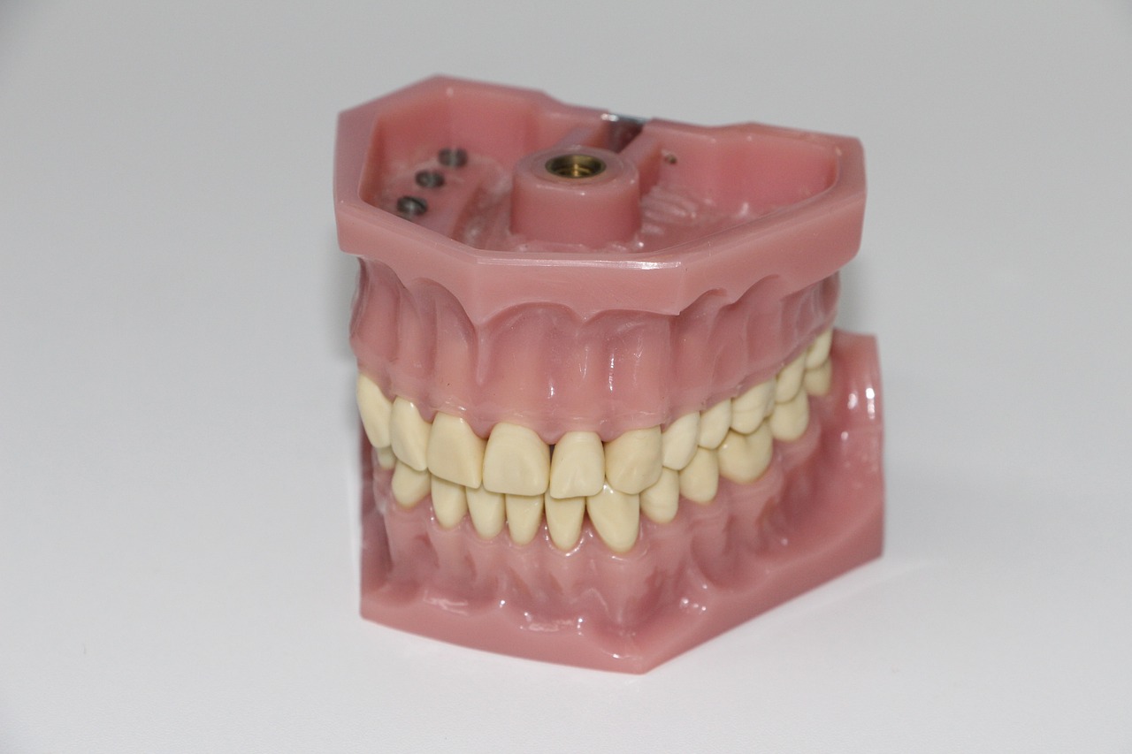 dental prosthesis, artificial teeth, dentition-1514697.jpg